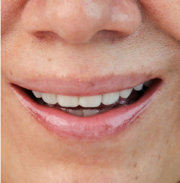 Basic Balm Lips