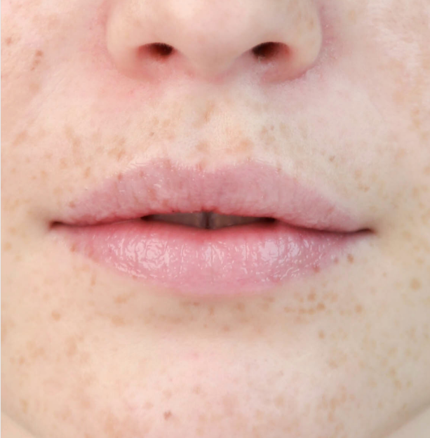 Basic Balm Lips